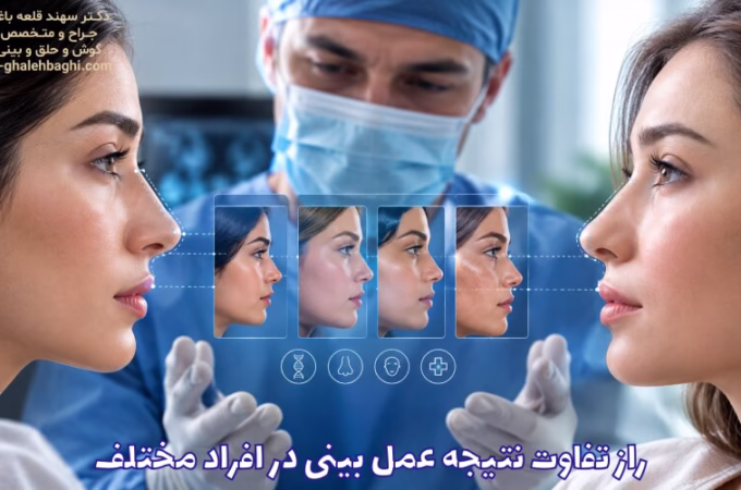راز تفاوت نتیجه عمل بینی در افراد مختلف