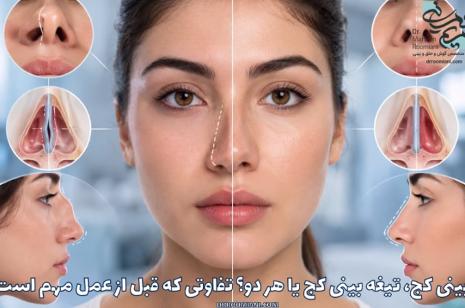 بینی کج، تیغه بینی کج یا هر دو؟ تفاوتی که قبل از عمل مهم است