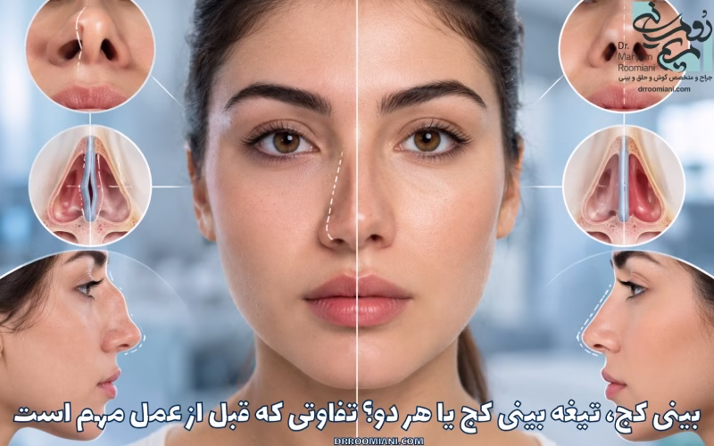 بینی کج، تیغه بینی کج یا هر دو؟ تفاوتی که قبل از عمل مهم است